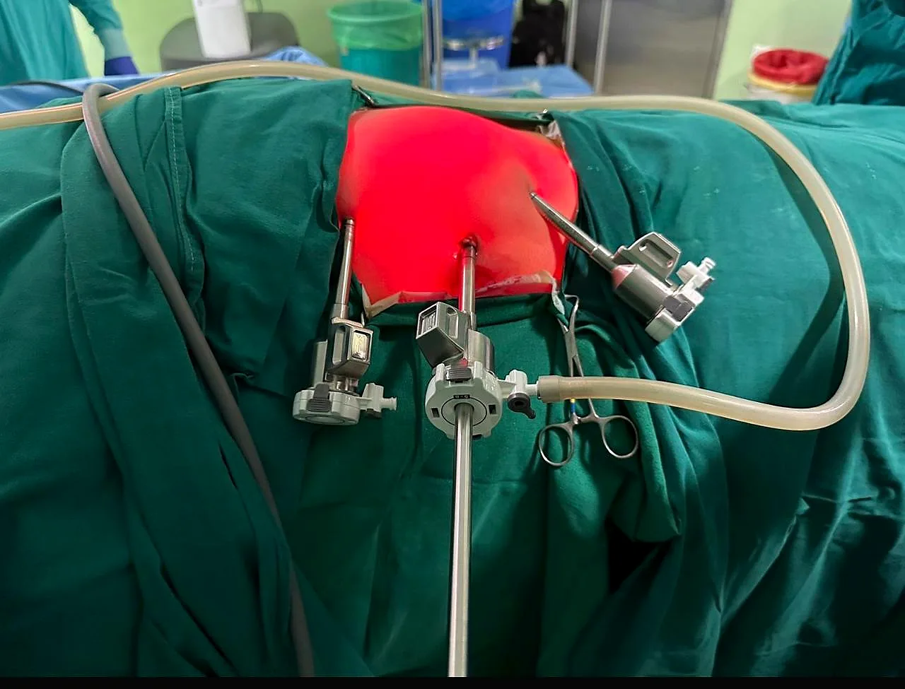 Dr. Hussain Kotawala Post-Surgery Consultation