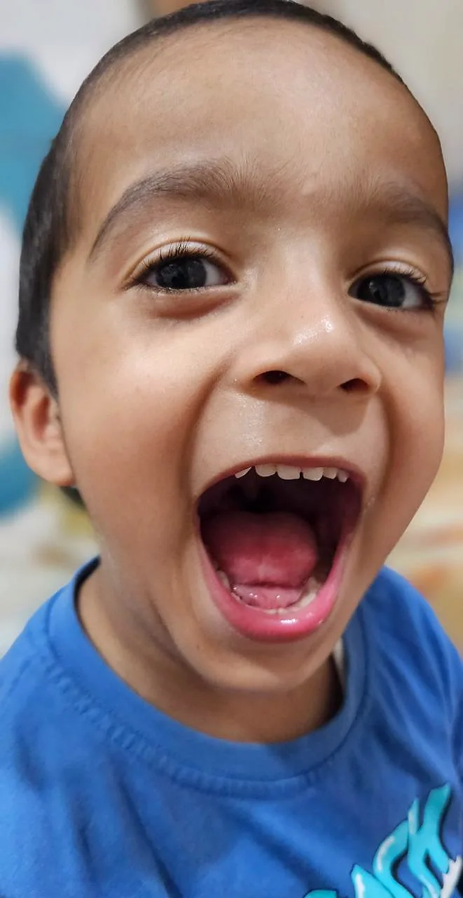 Successful Pediatric Surgery Recovery Moment